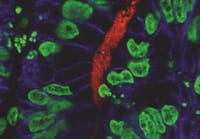 Crece la gravedad de una parasitosis