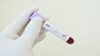 El virus VIH causa envejecimiento prematuro
