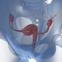 El tratamiento estresa a las mujeres en terapias de fertilidad