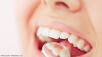 Gingivitis aumenta riesgo de cáncer