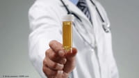 Pruebas de orina para detectar cáncer