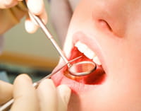 Lavanda para visita al dentista