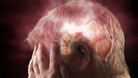 Terapia para derrame muestra resultados prometedores