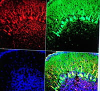 Descubren propiedades del yodo para combatir el cáncer