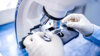 China prueba la técnica CRISPR en humanos