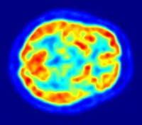 Desarrollan un 'código de barras' para mapear el cerebro