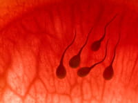Más riesgo de cáncer entre los hombres que no producen esperma
