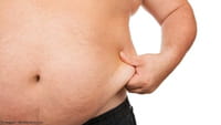 Obesidad eleva riesgo de padecer cáncer