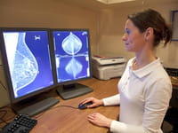 Resuelven misterio sobre el origen del cáncer de mama