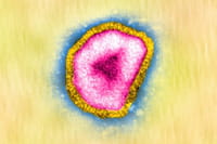 Entérate ¿Qué es el virus H7N9?
