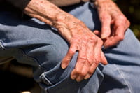 Una mutación genética aumenta el riesgo de Parkinson vinculado a pesticidas