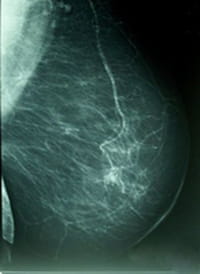Investigadores proponen una nueva clasificación de los tipos de cáncer