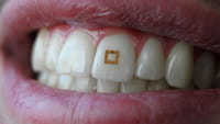 Un chip bucal para controlar la dieta