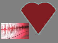 Hacer crecer un marcapasos biológico dentro de un corazón dañado