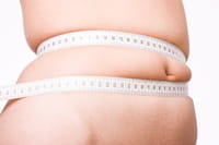 La flora intestinal determina la salud de las personas obesas