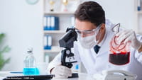 Examen de sangre para detectar cáncer