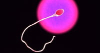 La eyaculación frecuente mejora la calidad del ADN en los espermatozoides