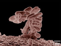 En Europa Cada año hay 400.000 infecciones graves por bacterias multirresistentes