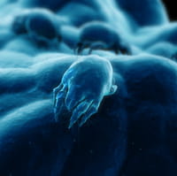 Cambios ambientales causan incremento de alergias respiratorias