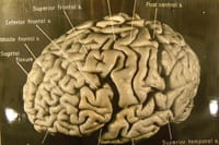 Ejercicio breve pero intenso: riesgos y beneficios