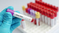 Nueva epidemia en África