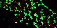 Nuevo modo de generar células productoras de insulina en pacientes con diabetes tipo 1