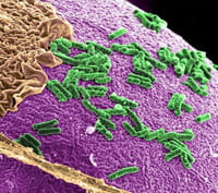 Los microbios en el intestino ayudan a determinar el riesgo de tumores