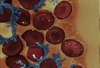 Conmutador molecular controlado por láser para regular a voluntad la coagulación de la sangre