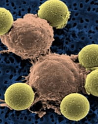Descifran células que causan leucemia