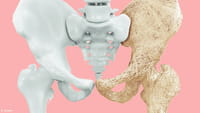 Salvia china contra la osteoporosis