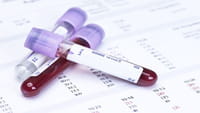 Descubrimiento clave contra la leucemia