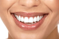 Nuevas técnicas para la sonrisa perfecta