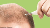 Compuesto contra las canas y la alopecia