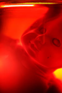 Un nuevo análisis de sangre durante el embarazo puede reducir en un 95% la realización de amniocentesis
