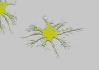 Identifican un problema metabólico que puede ser un precursor del Mal de Alzheimer