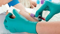 Gran avance en la detección del cáncer