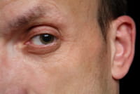 Asocian el alzhéimer con la pérdida de espesor de dos capas de la retina