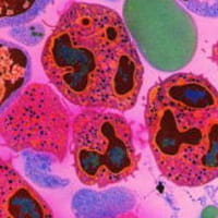 Descubren 74 nuevos errores genéticos asociados al cáncer