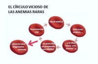La anemia en el contexto de las enfermedades raras