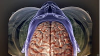 ¿Puede un tumor cerebral o una lesión determinar nuestro comportamiento?