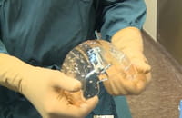 Un cráneo completo impreso con tecnología en 3D