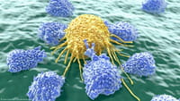 Combatir el cáncer por control remoto