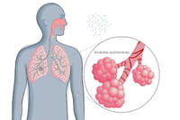 Una de las vacunas contra la tuberculosis, ineficaz para el paciente y útil para el científico