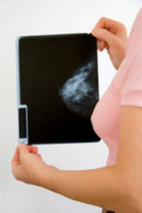 La Hormonoterapia es segura cuando hay receptores hormonales positivos