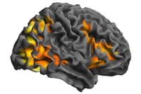 Una sola conmoción podría dar paso a un daño cerebral duradero