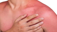Fin de los 'solariums' para prevenir el cáncer