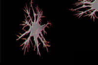 Trasplante prometedor de células cerebrales para revertir la pérdida de memoria en el Alzheimer