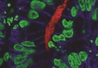Crece la gravedad de una parasitosis
