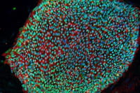 Desarrollan un nuevo modelo de inmunoterapia contra el cáncer al ajustar las células Treg
