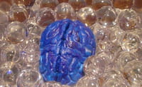 Una nueva técnica revela bajo nivel de hierro cerebral en pacientes con TDAH